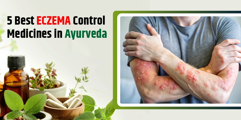 eczema-control-medicines-in-ayurveda